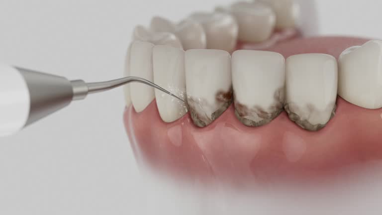 Trusted Tooth Extraction service in West Ocean City, MD - Dentist Open Now